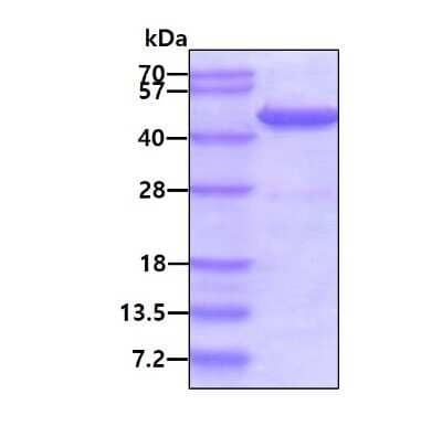 SDS-PAGE: Recombinant Human GCDH His Protein [NBP1-50838]